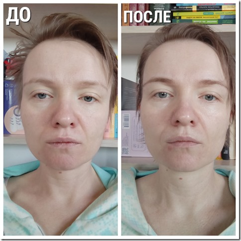 маска iFace Gezatone отзывы, фото до и после